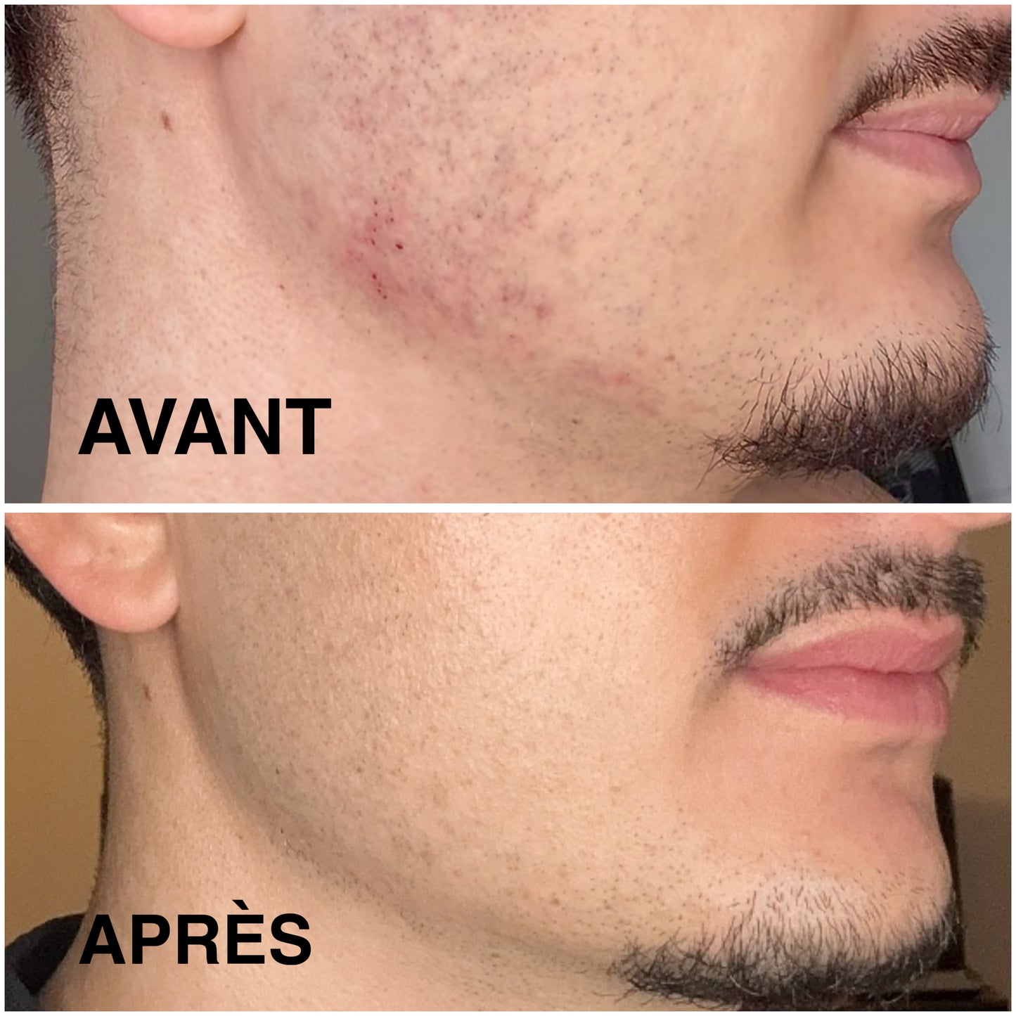 Soin visage homme  nettoyant hydratant nourrissant Monsieur Simple irritation 